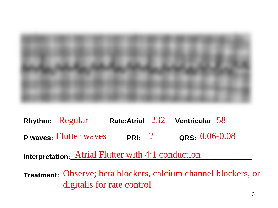 EKG Homework Instructor.ppt_diwiubrqjsk_page3