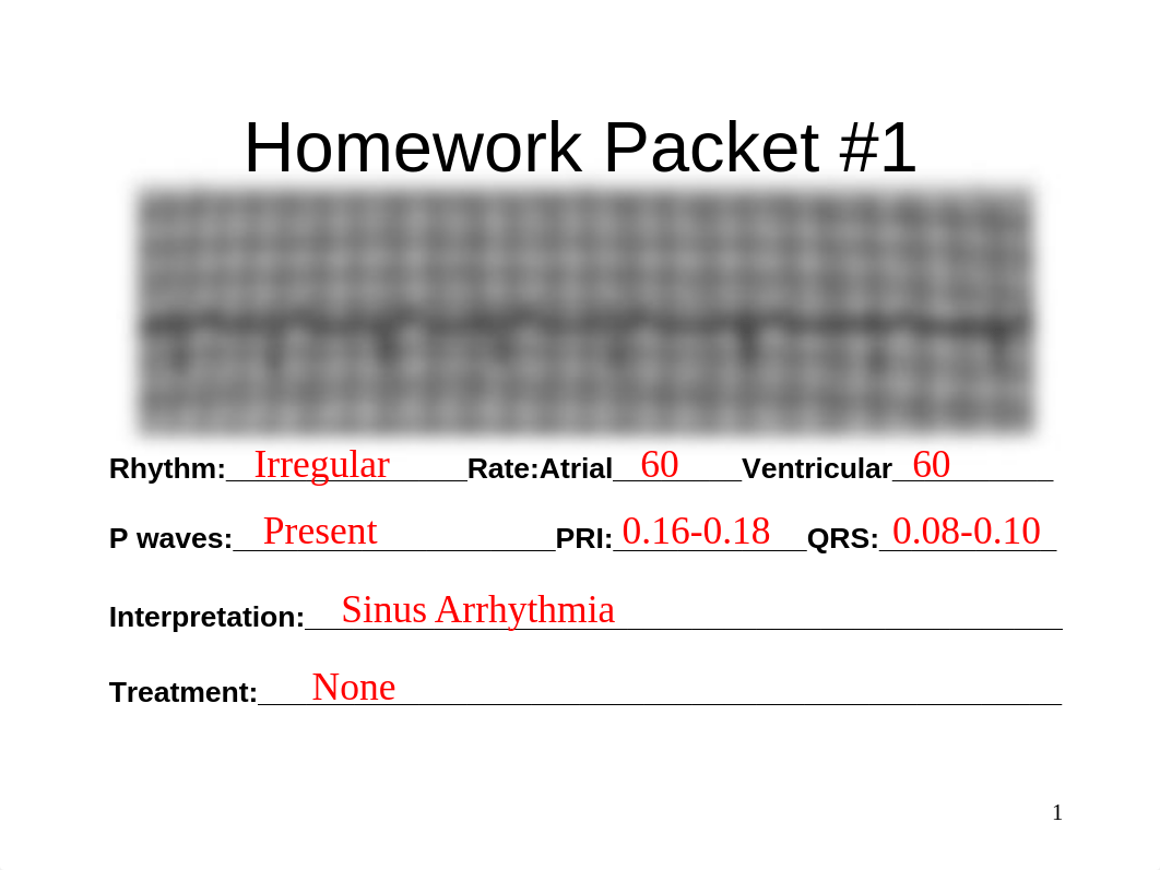 EKG Homework Instructor.ppt_diwiubrqjsk_page1