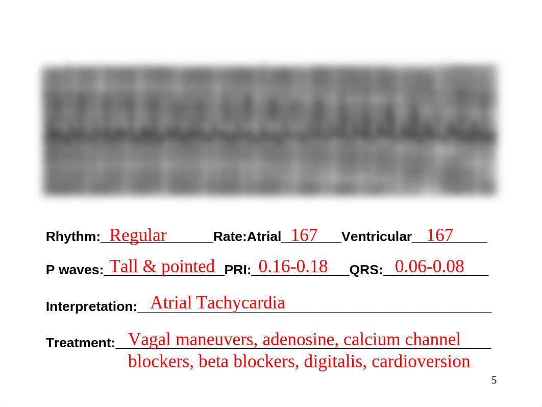 EKG Homework Instructor.ppt_diwiubrqjsk_page5