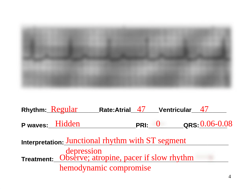 EKG Homework Instructor.ppt_diwiubrqjsk_page4