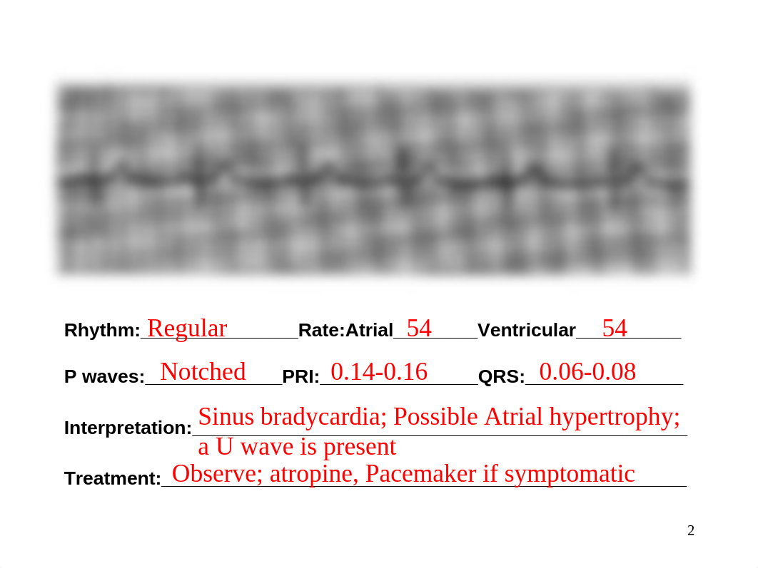 EKG Homework Instructor.ppt_diwiubrqjsk_page2