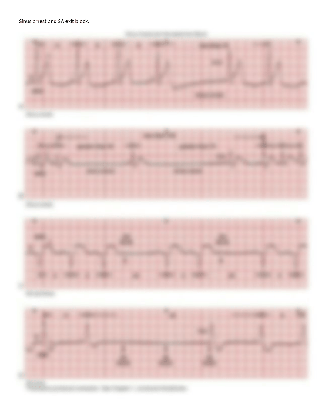 EKG- All Rhythm and Treatment Class Practice Handouts_dj5wm9bij7r_page4