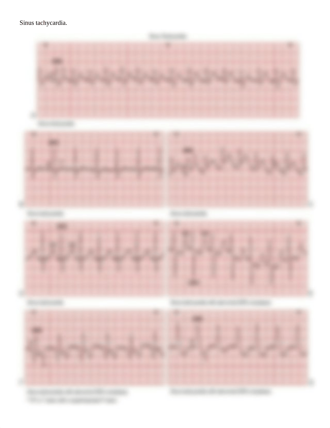 EKG- All Rhythm and Treatment Class Practice Handouts_dj5wm9bij7r_page5