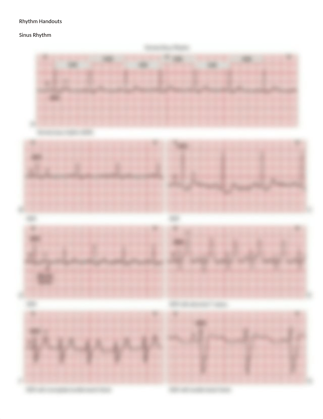 EKG- All Rhythm and Treatment Class Practice Handouts_dj5wm9bij7r_page1