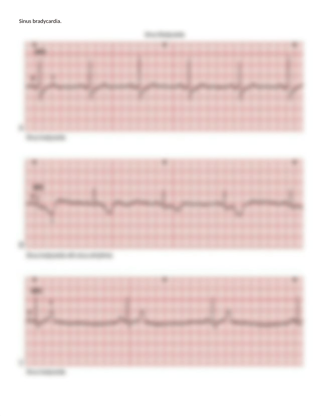 EKG- All Rhythm and Treatment Class Practice Handouts_dj5wm9bij7r_page3