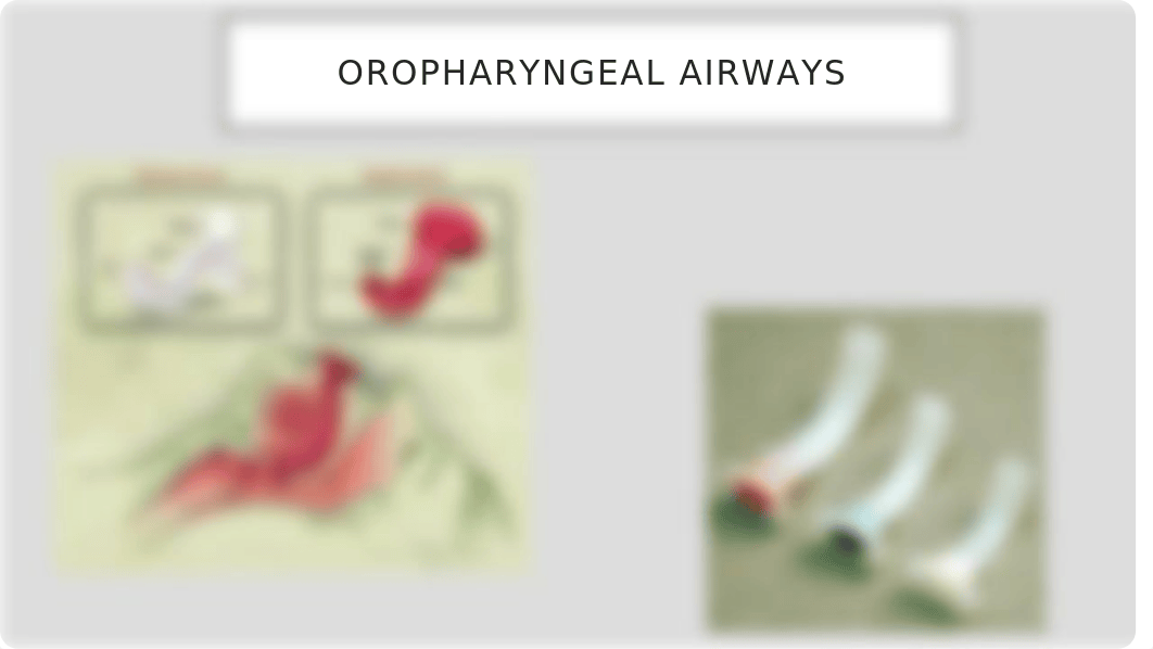 2. Mechanical ventilation v2.pptx_dj7f79qb848_page4