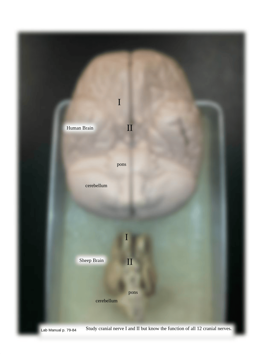 Brain and sheep brain (1).pdf_dj7g46fz0ml_page3