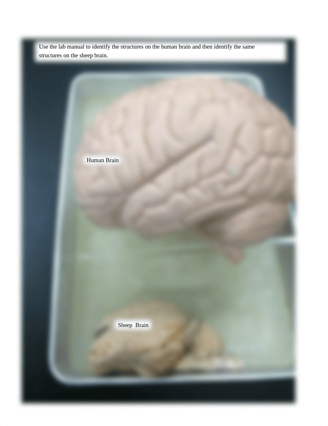 Brain and sheep brain (1).pdf_dj7g46fz0ml_page1