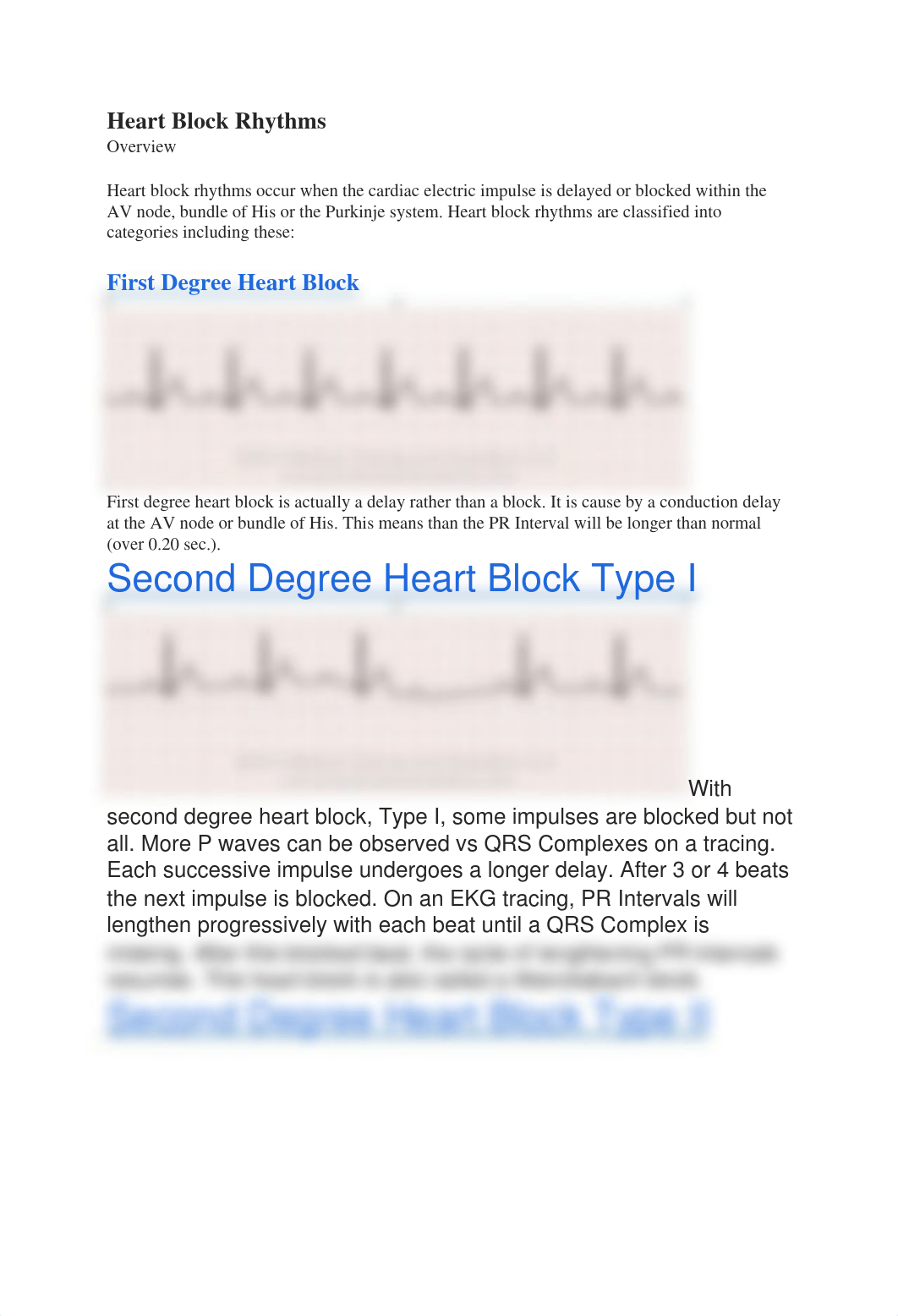 Heart Block Rhythms.docx_dj7zm321lmu_page1