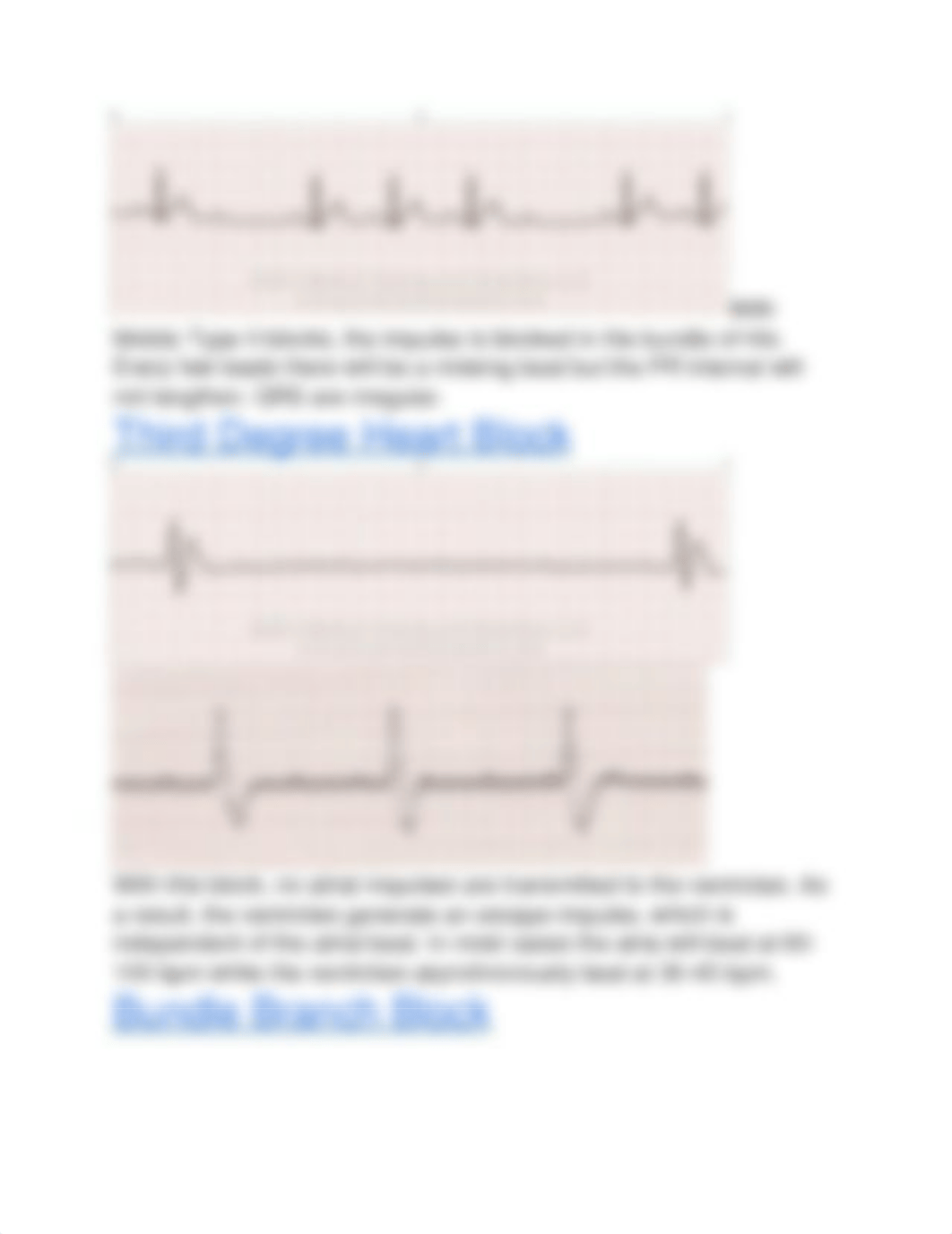 Heart Block Rhythms.docx_dj7zm321lmu_page2