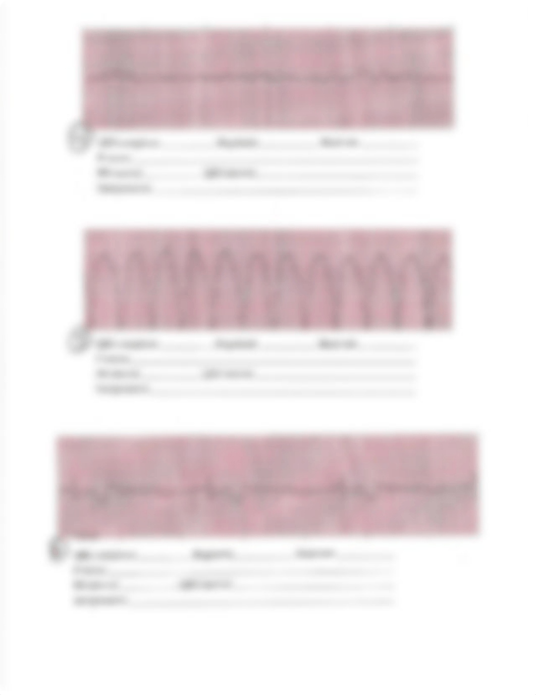 Dysrhythmias Exam strips (1).pdf_dj812hfklaj_page2