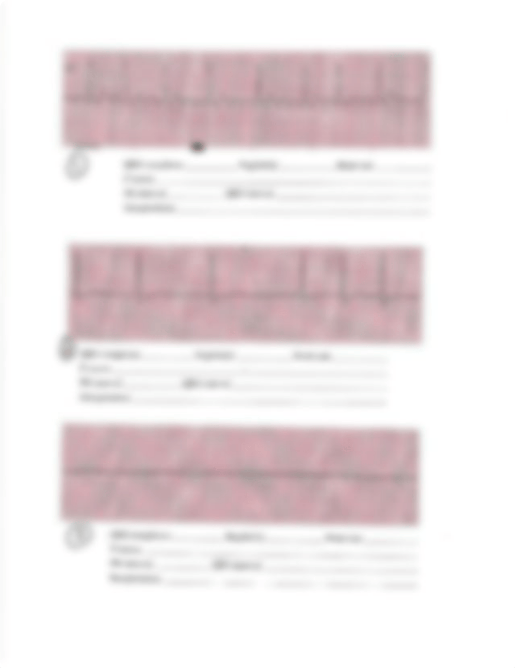 Dysrhythmias Exam strips (1).pdf_dj812hfklaj_page1