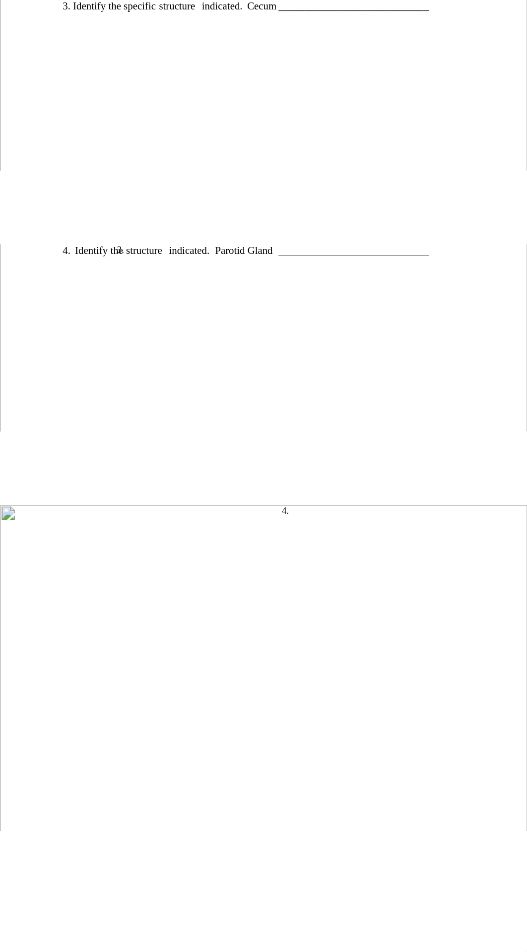 A&P2 Lab Quiz 4.docx_dj8buvjsoas_page2