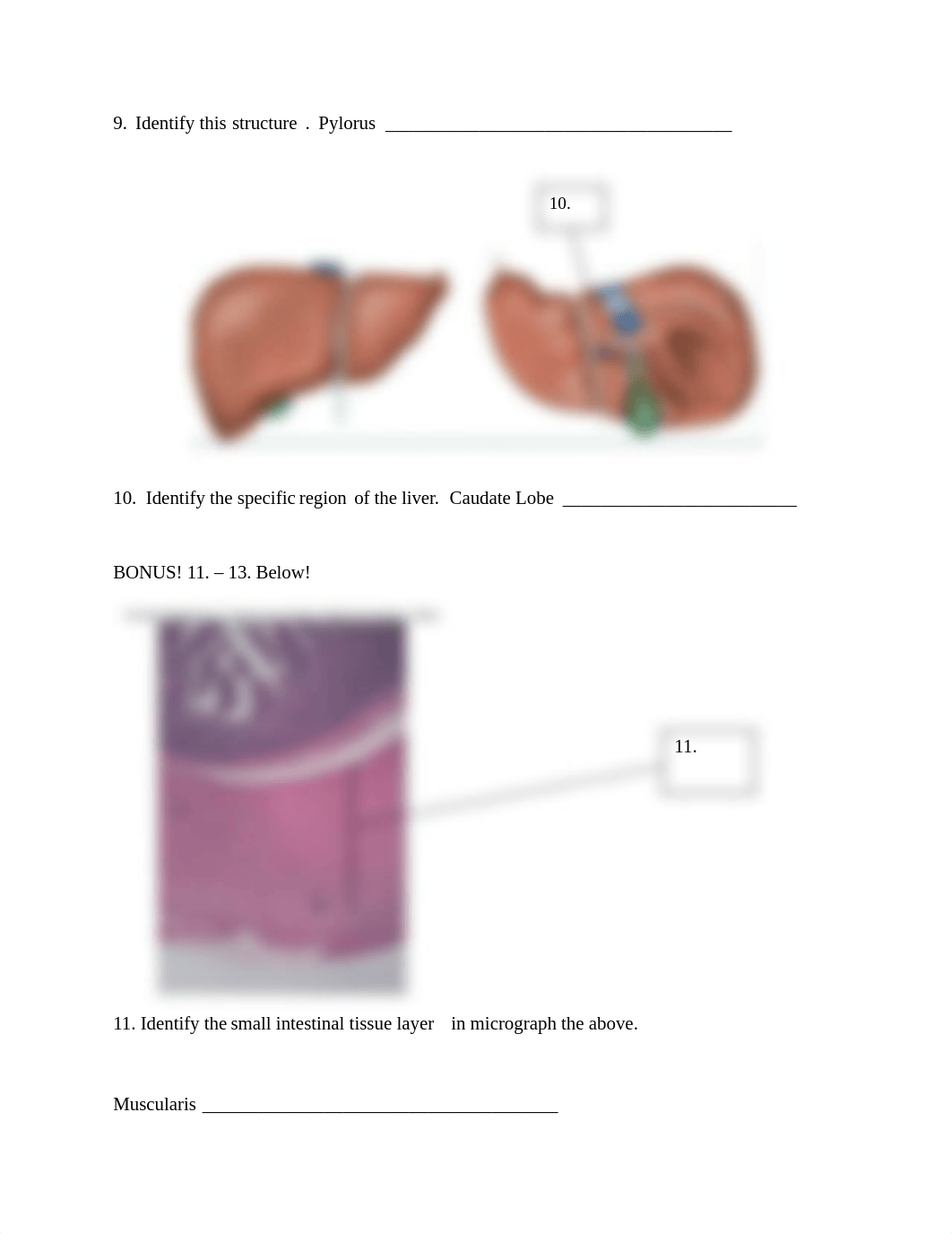 A&P2 Lab Quiz 4.docx_dj8buvjsoas_page5