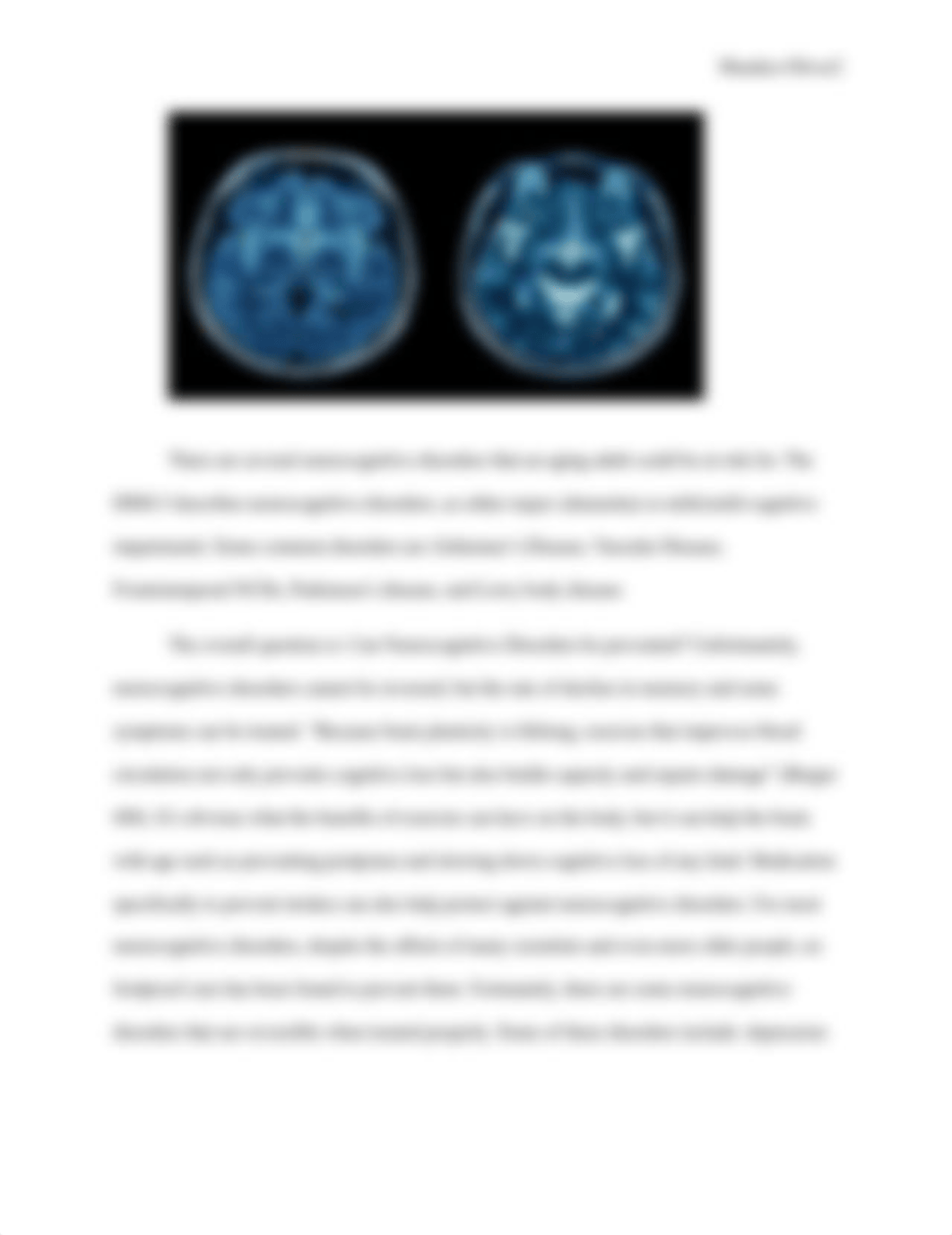 Aging and the Brain.docx_djaabrl7ef3_page2