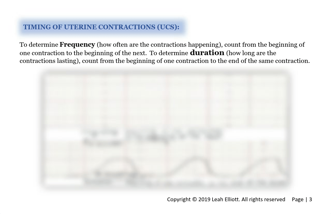 Nurse_Reference_Guide-Introduction to Basic Fetal Monitoring.pdf_djb3yx0ojgd_page3