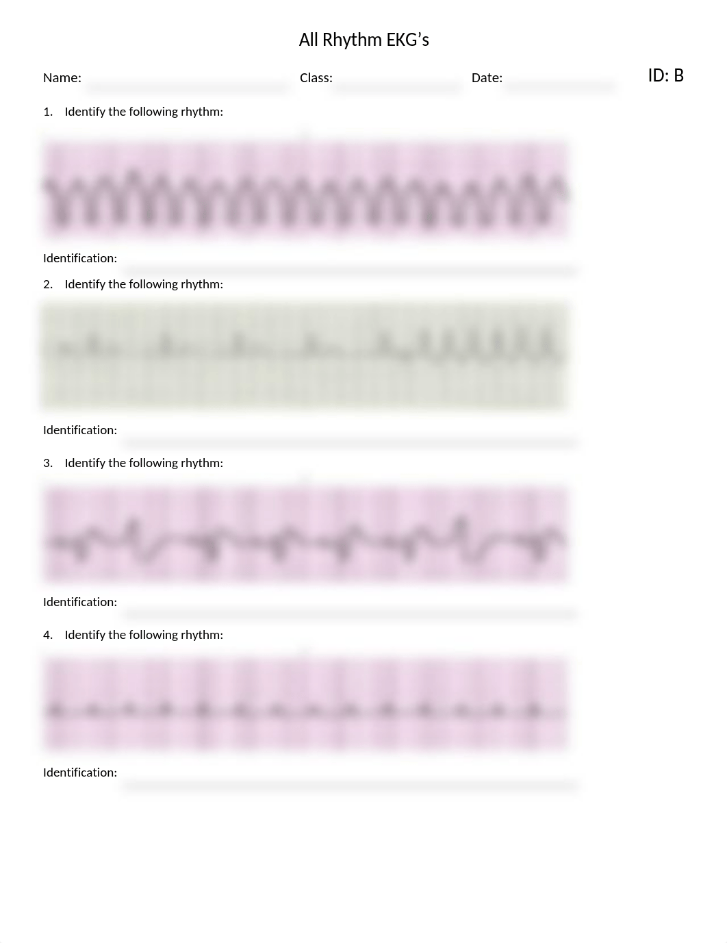 All EKG Test B.docx_djbv1jss6jl_page1