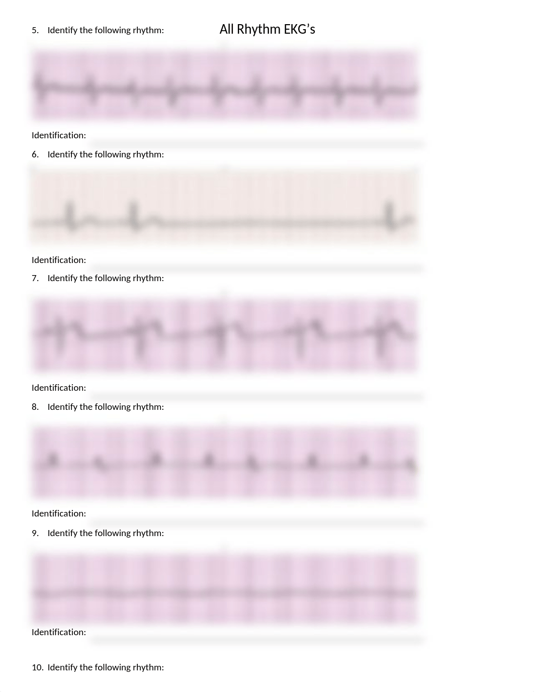 All EKG Test B.docx_djbv1jss6jl_page2