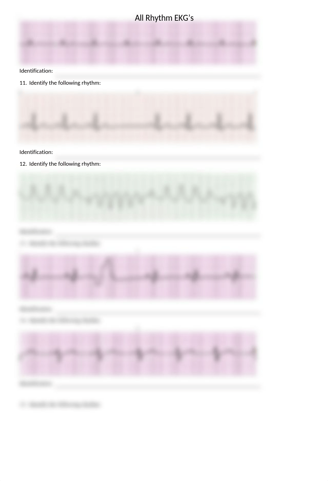 All EKG Test B.docx_djbv1jss6jl_page3