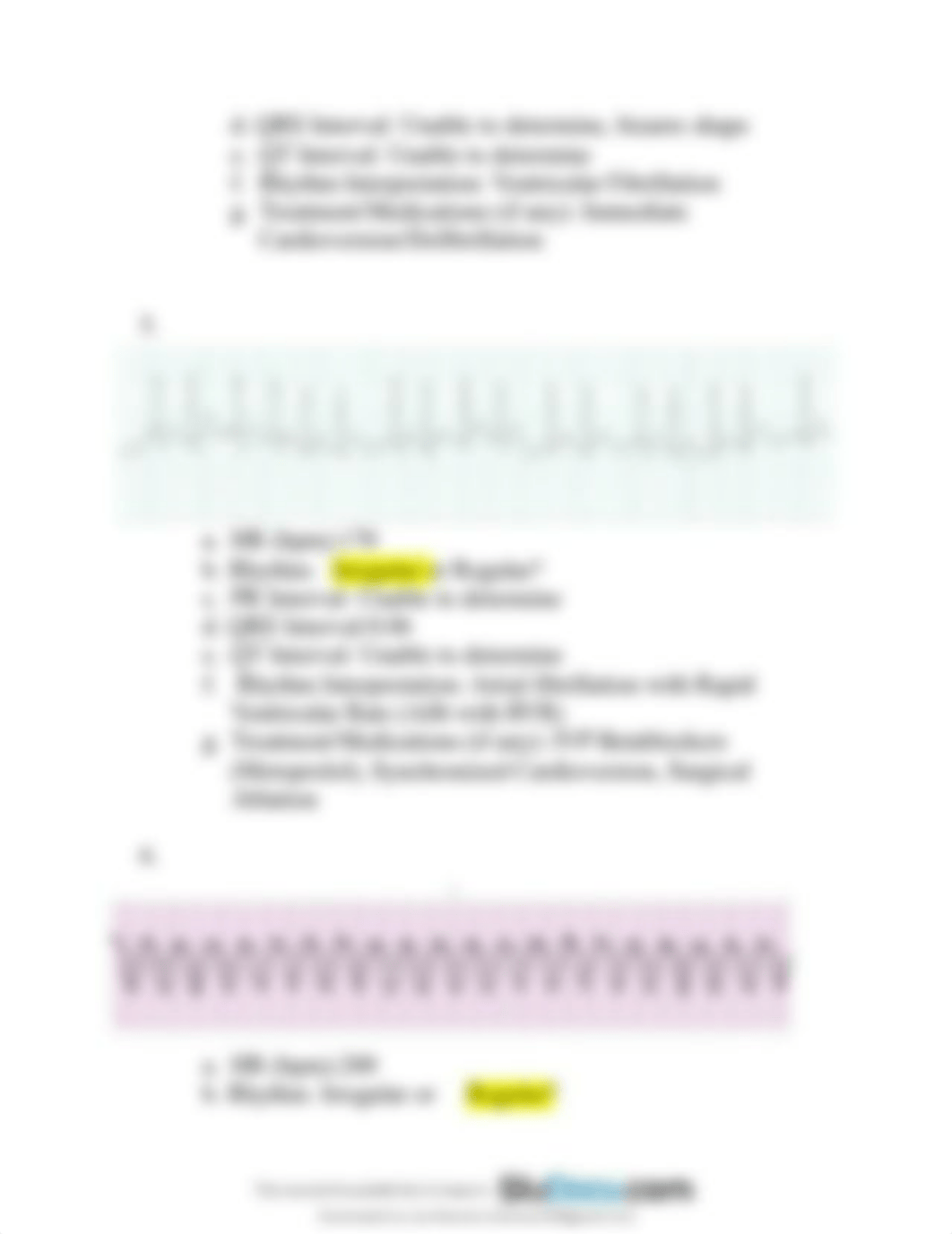 ekg-interpretation-with-answers EKG.pdf_djd54h8bsxw_page4