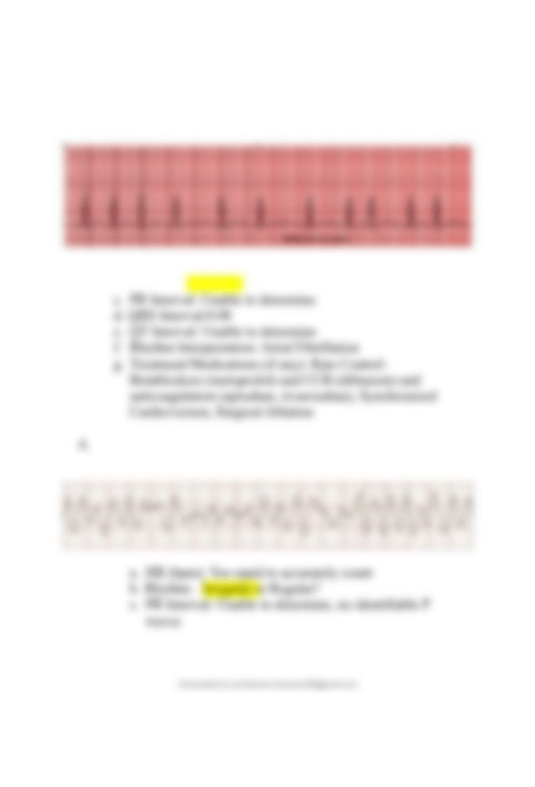 ekg-interpretation-with-answers EKG.pdf_djd54h8bsxw_page3