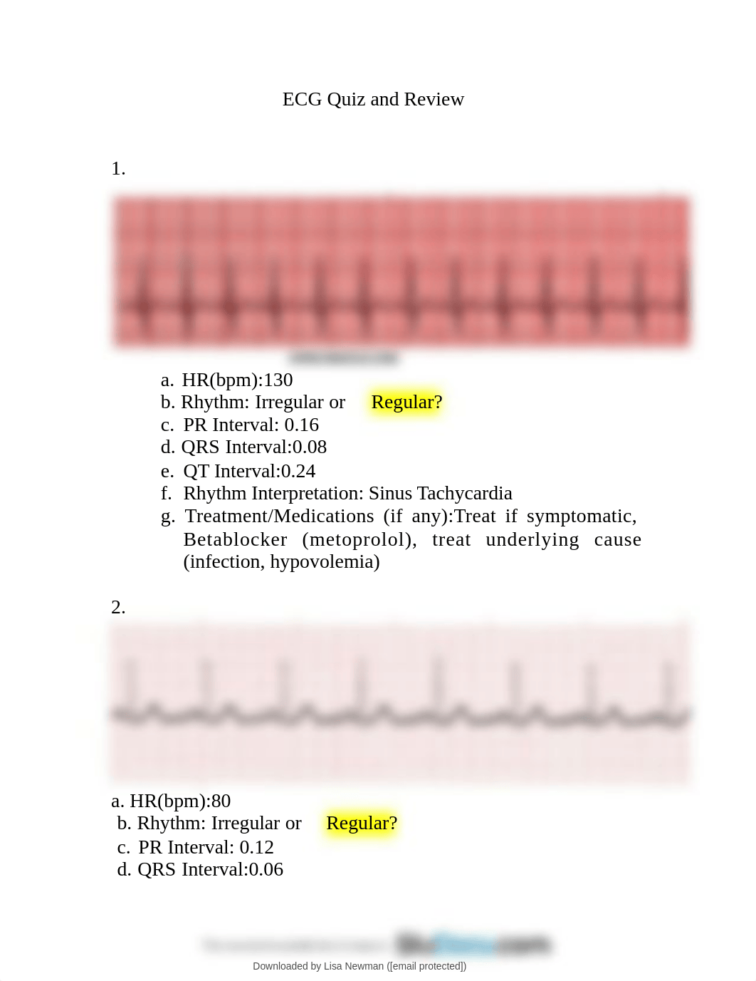 ekg-interpretation-with-answers EKG.pdf_djd54h8bsxw_page2