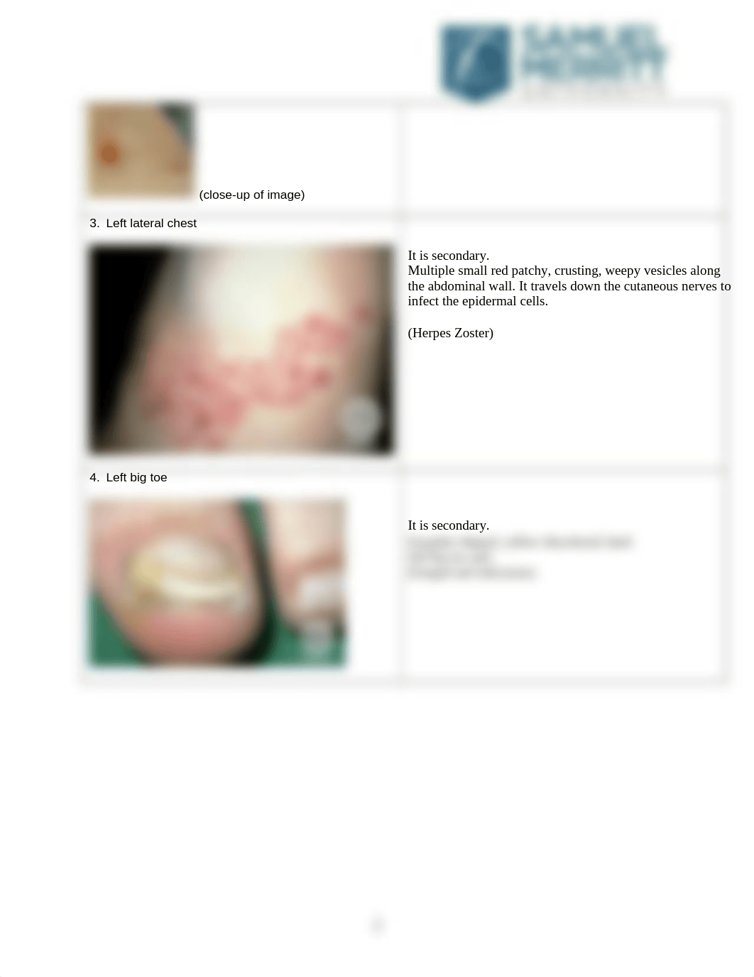 Dermatologic Conditions Descriptions Worksheet.docx_djhhmf4afcr_page2