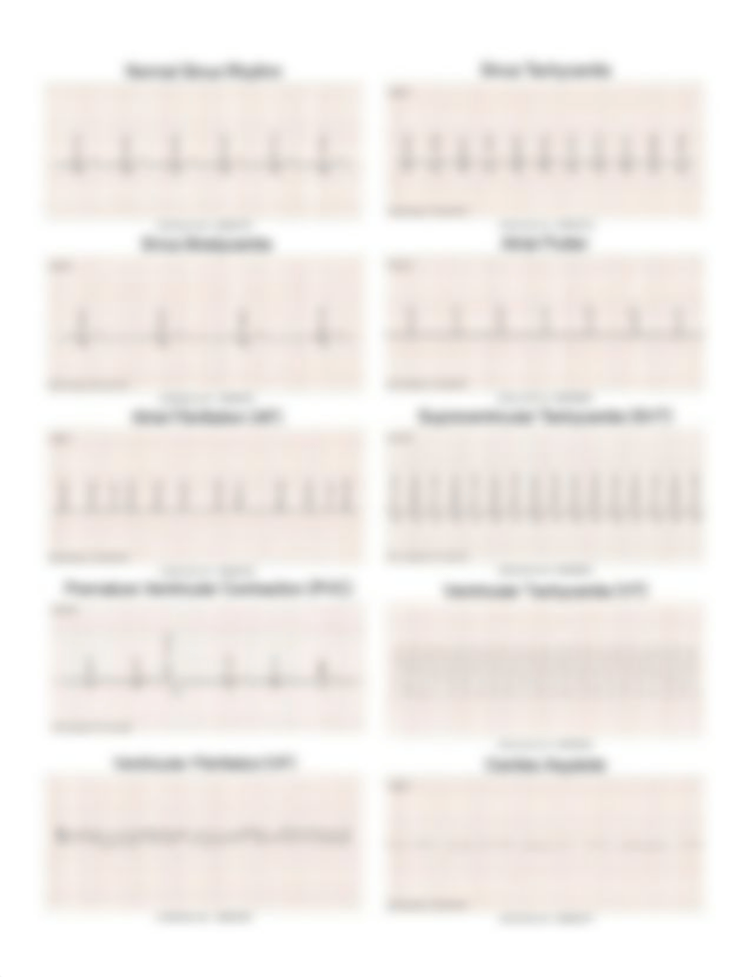 Dysrhythmia ECG strips.docx_djkcv8ajh19_page1