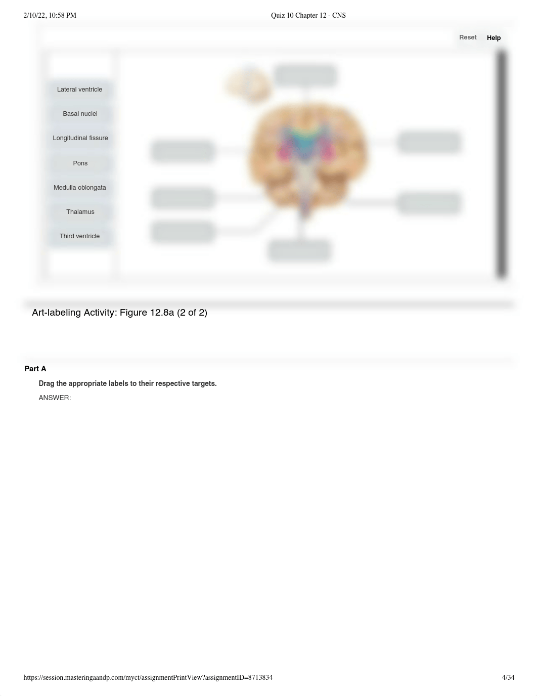 Quiz 10 Chapter 12 - CNS.pdf_djnsjtkitjs_page4