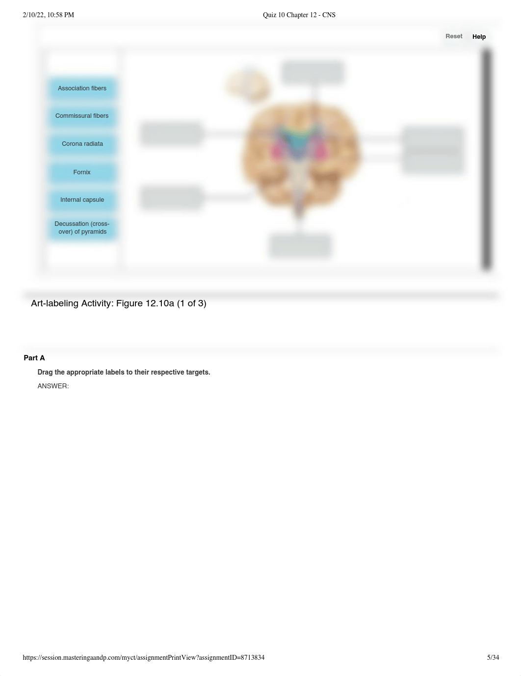 Quiz 10 Chapter 12 - CNS.pdf_djnsjtkitjs_page5