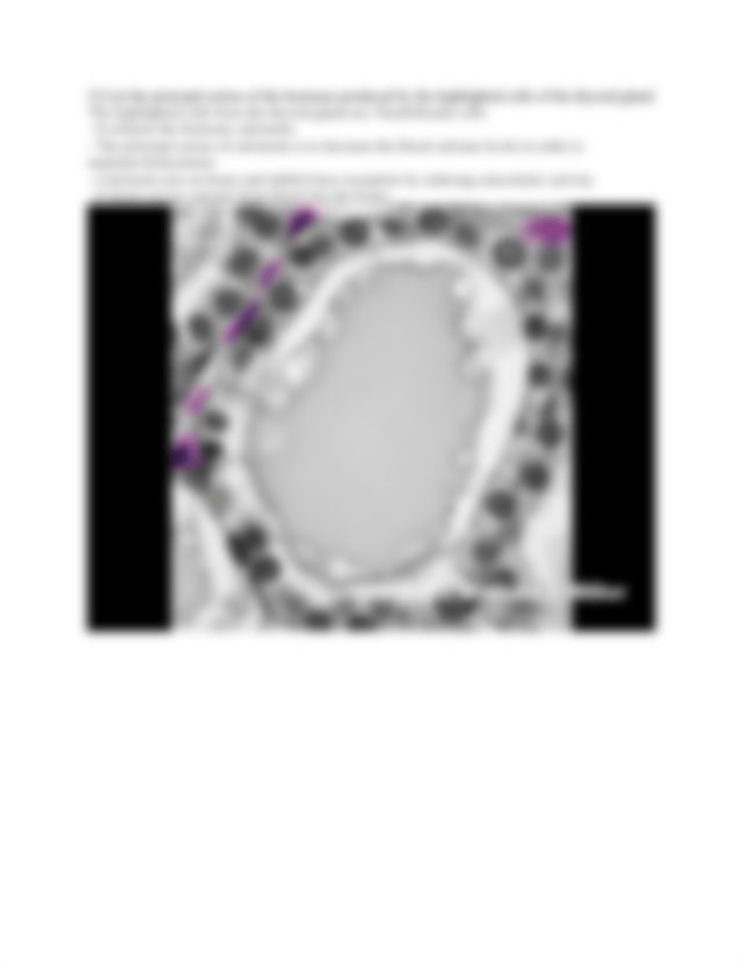 ZD Hormone actions no ans worksheet (1).docx_djp9n1fway3_page5