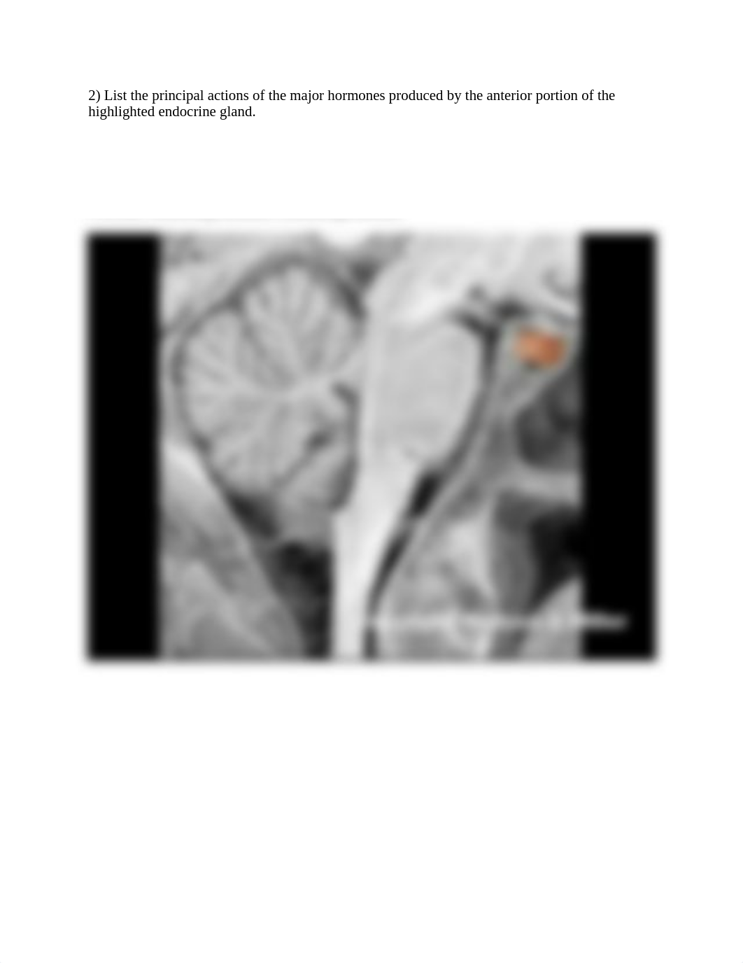 ZD Hormone actions no ans worksheet (1).docx_djp9n1fway3_page2