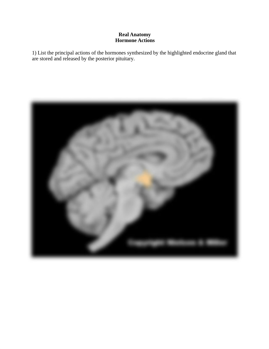 ZD Hormone actions no ans worksheet (1).docx_djp9n1fway3_page1