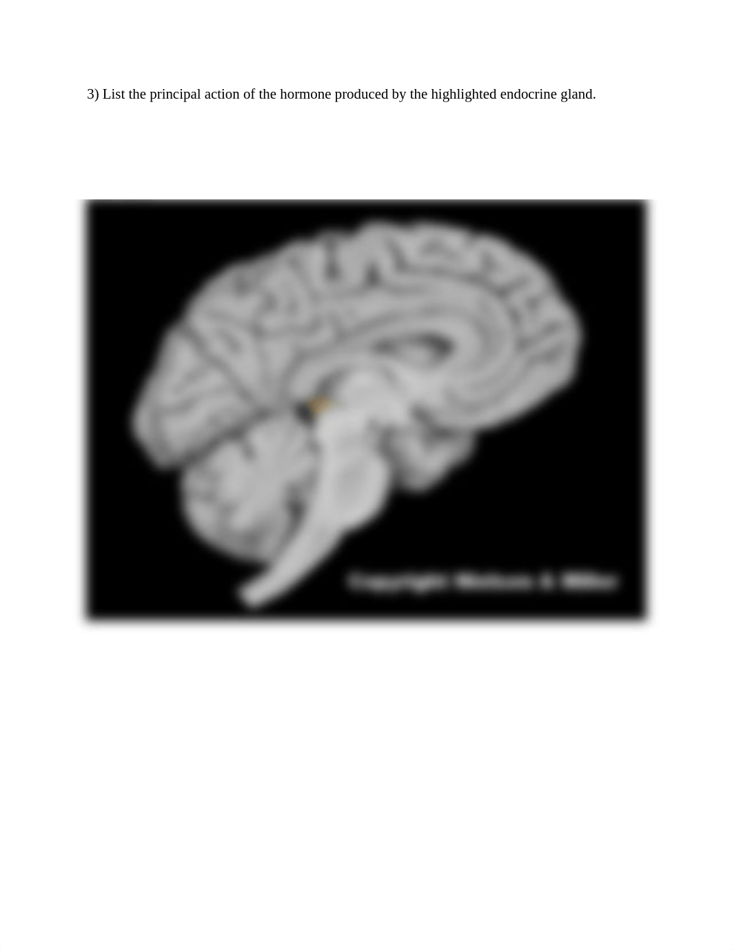 ZD Hormone actions no ans worksheet (1).docx_djp9n1fway3_page3