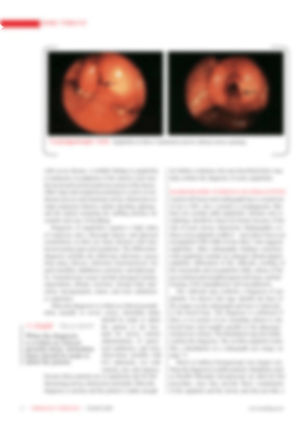 NU7060 - A - Sore Throat - Navigating the Differential Diagnosis.pdf_djujj62ae4h_page3