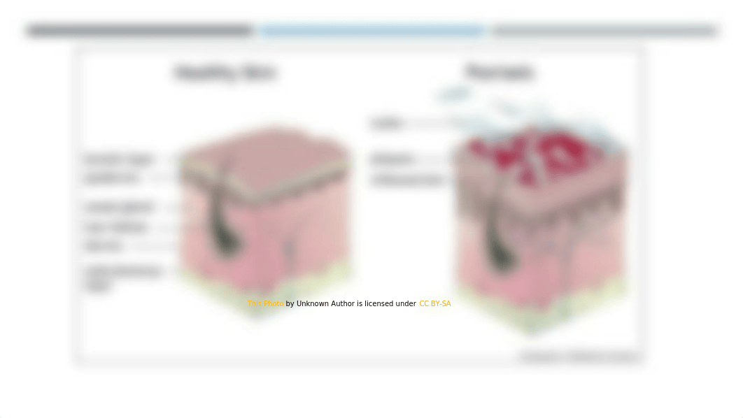 Psoriasis presentation.pptx_djza7o7hr4d_page2