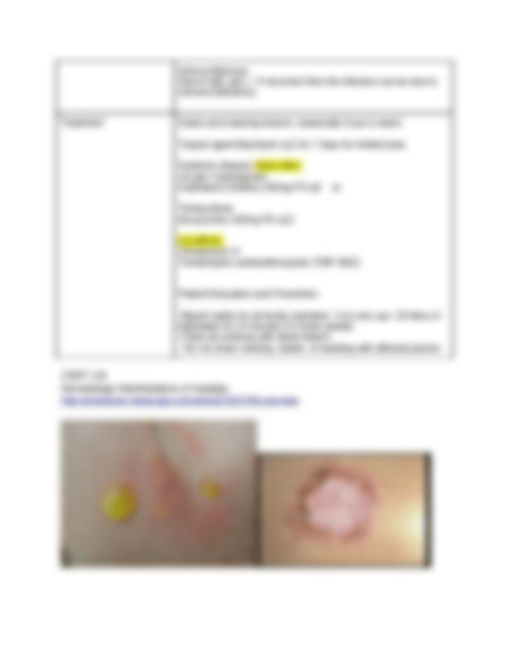 Impetigo_dk3537grwo3_page2