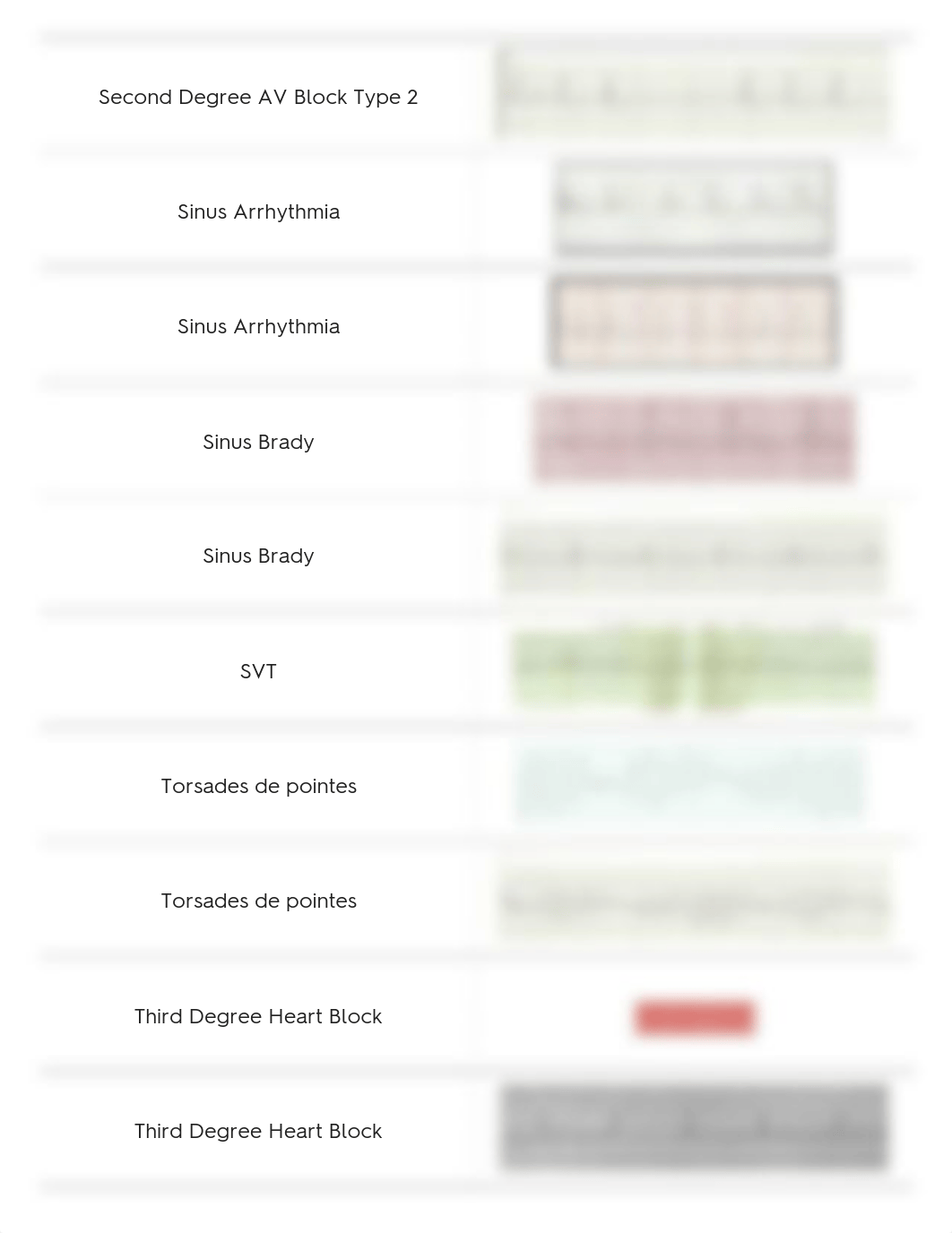 quizlet EKG.pdf_dkav6jow8k0_page4