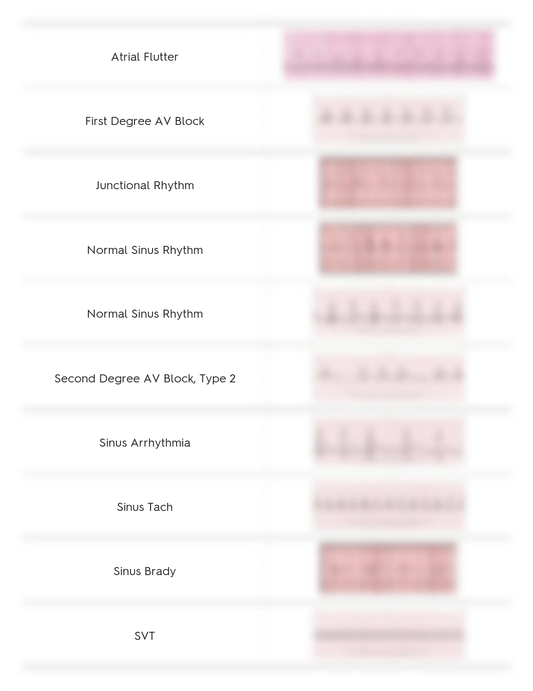 quizlet EKG.pdf_dkav6jow8k0_page1