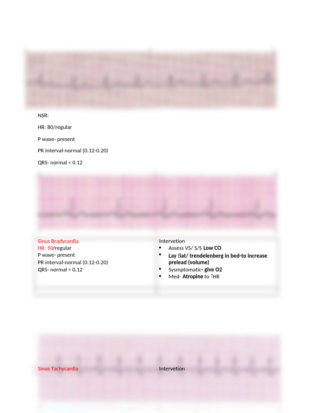 Rhythm Strip Pictures for flashcards.docx_dkiyuusum5h_page1