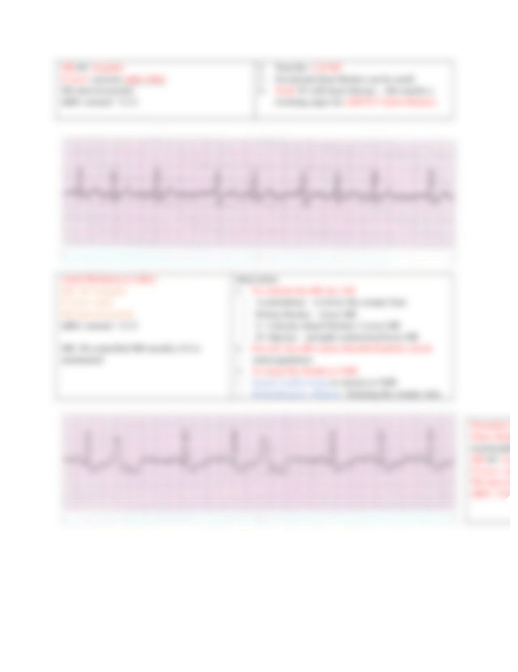 Rhythm Strip Pictures for flashcards.docx_dkiyuusum5h_page3