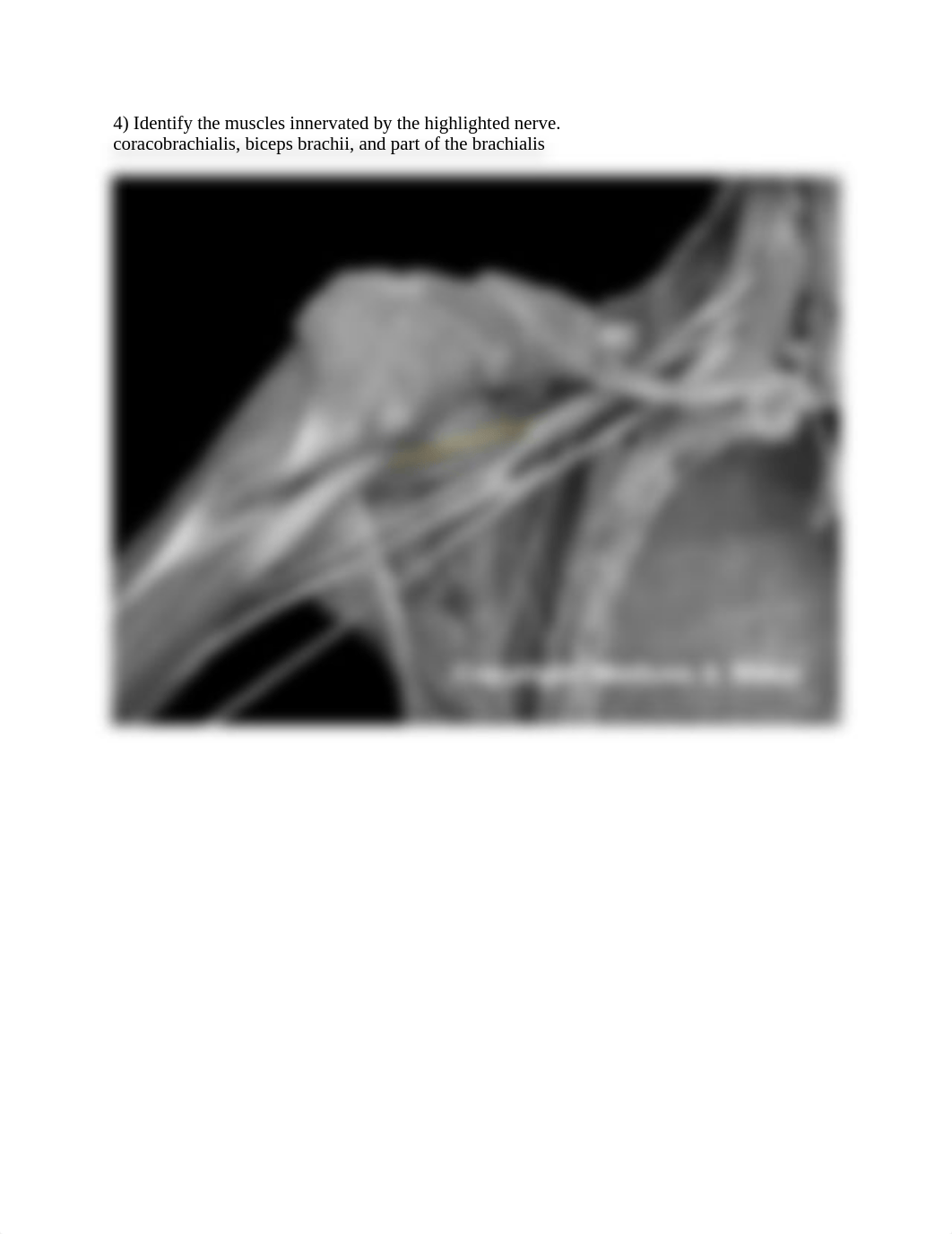 Ch 13 Real Anatomy answer key-for students (1).docx_dklbumf5i5q_page4