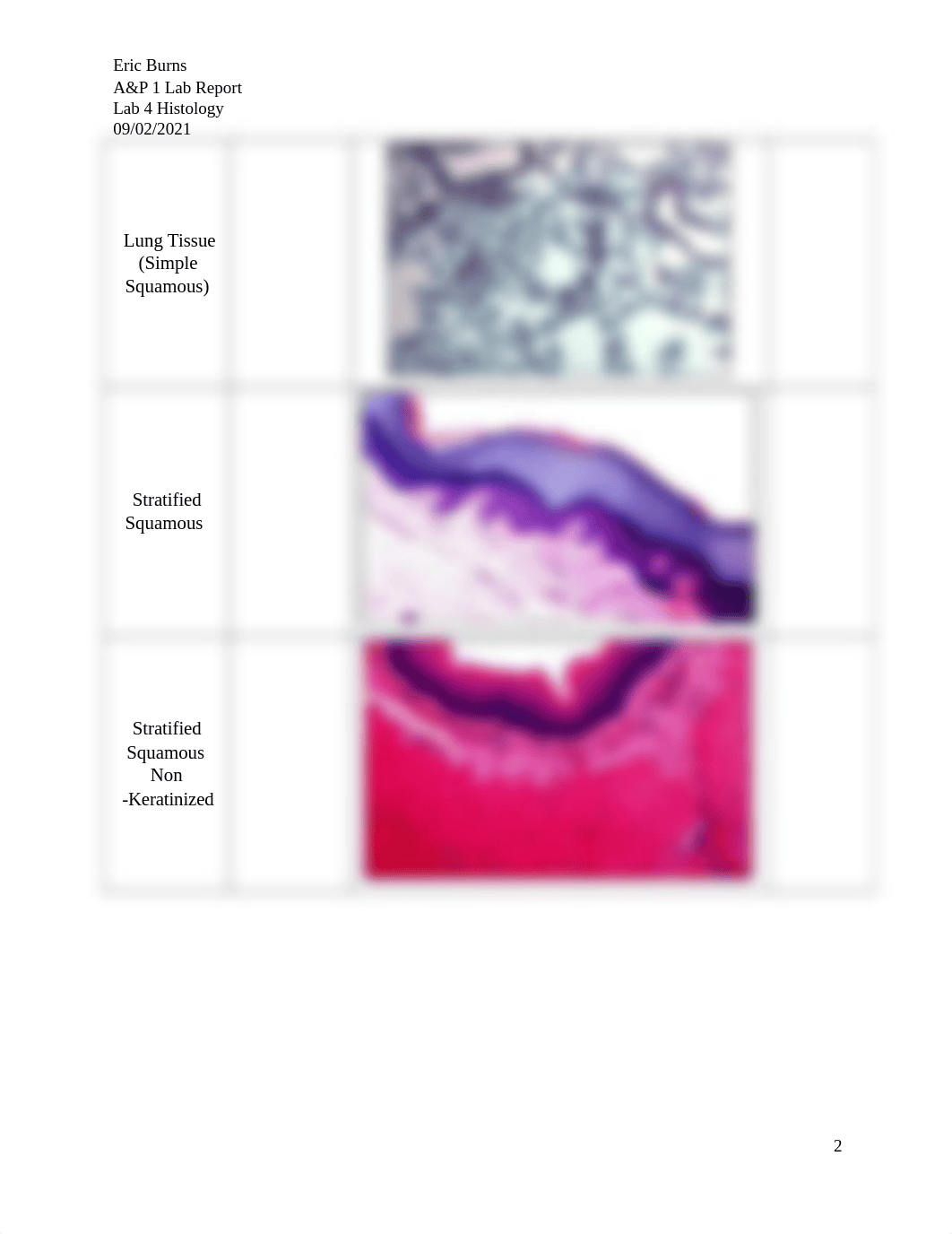 Eric.burns Lab Report 4 - Histology.docx_dkmvo7v47bp_page2