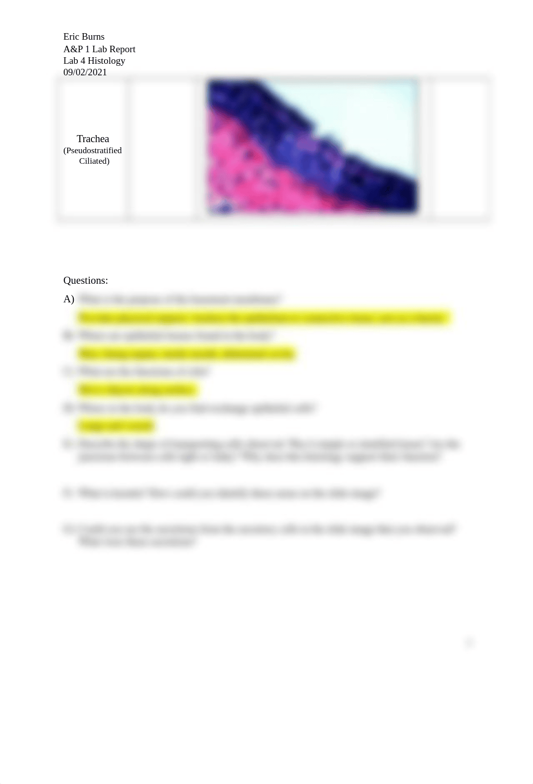 Eric.burns Lab Report 4 - Histology.docx_dkmvo7v47bp_page3