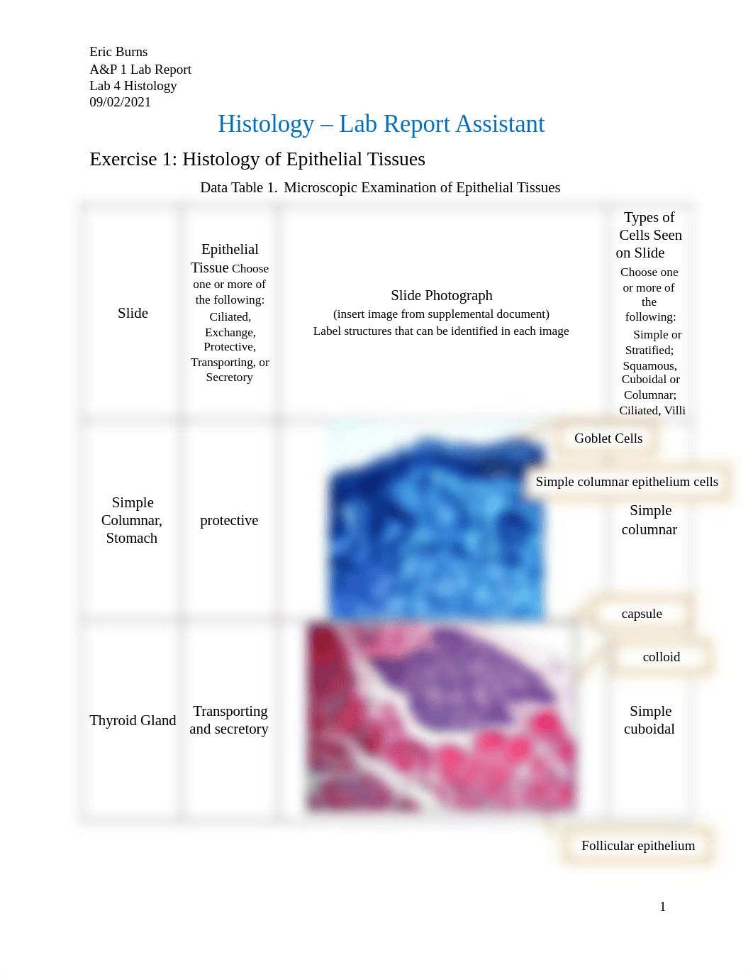 Eric.burns Lab Report 4 - Histology.docx_dkmvo7v47bp_page1