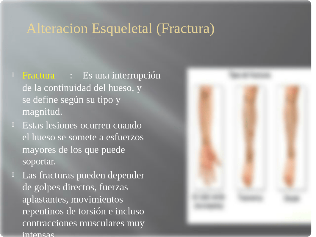 Alteración esqueletal trauma y fracturas.pptx_dko0ew2sopn_page5