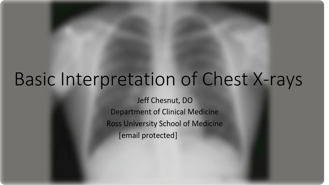 Basic Interpretation of Chest X-Rays.pdf_dkpc6ovzu6x_page1