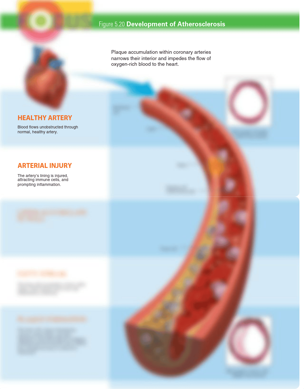 Development of Atherosclerosis - Ch5 Focus 5.20.pdf_dksvsdde91w_page1