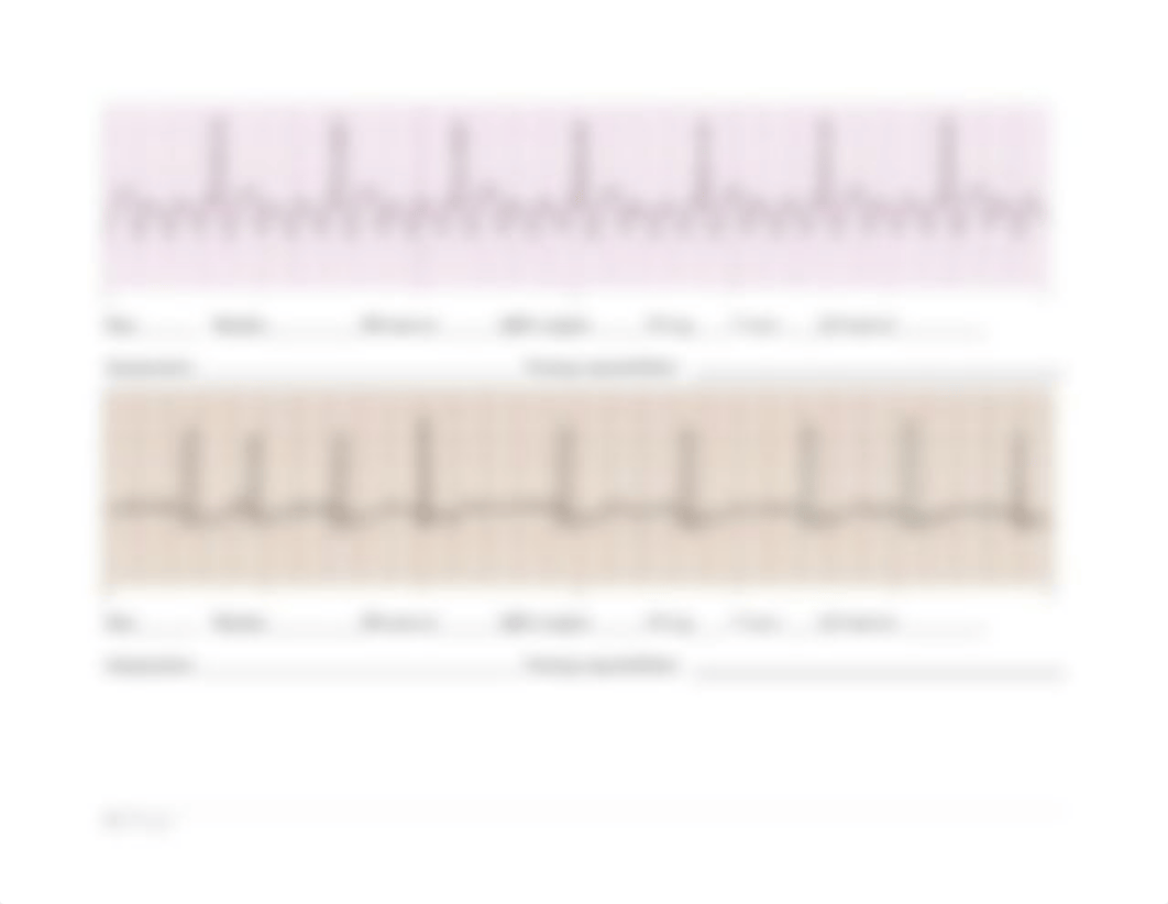 NUR 202 ECG Strip Student Practice.docx_dktszx2z4zv_page4