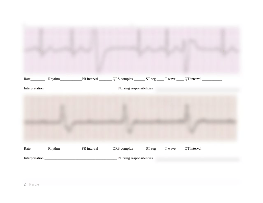 NUR 202 ECG Strip Student Practice.docx_dktszx2z4zv_page2